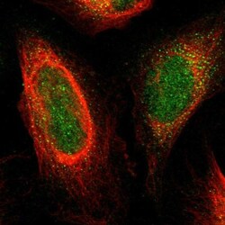 Plexin A1 Antibody, Novus Biologicals 0.1mL; Unlabeled:Antibodies, Polyclonal